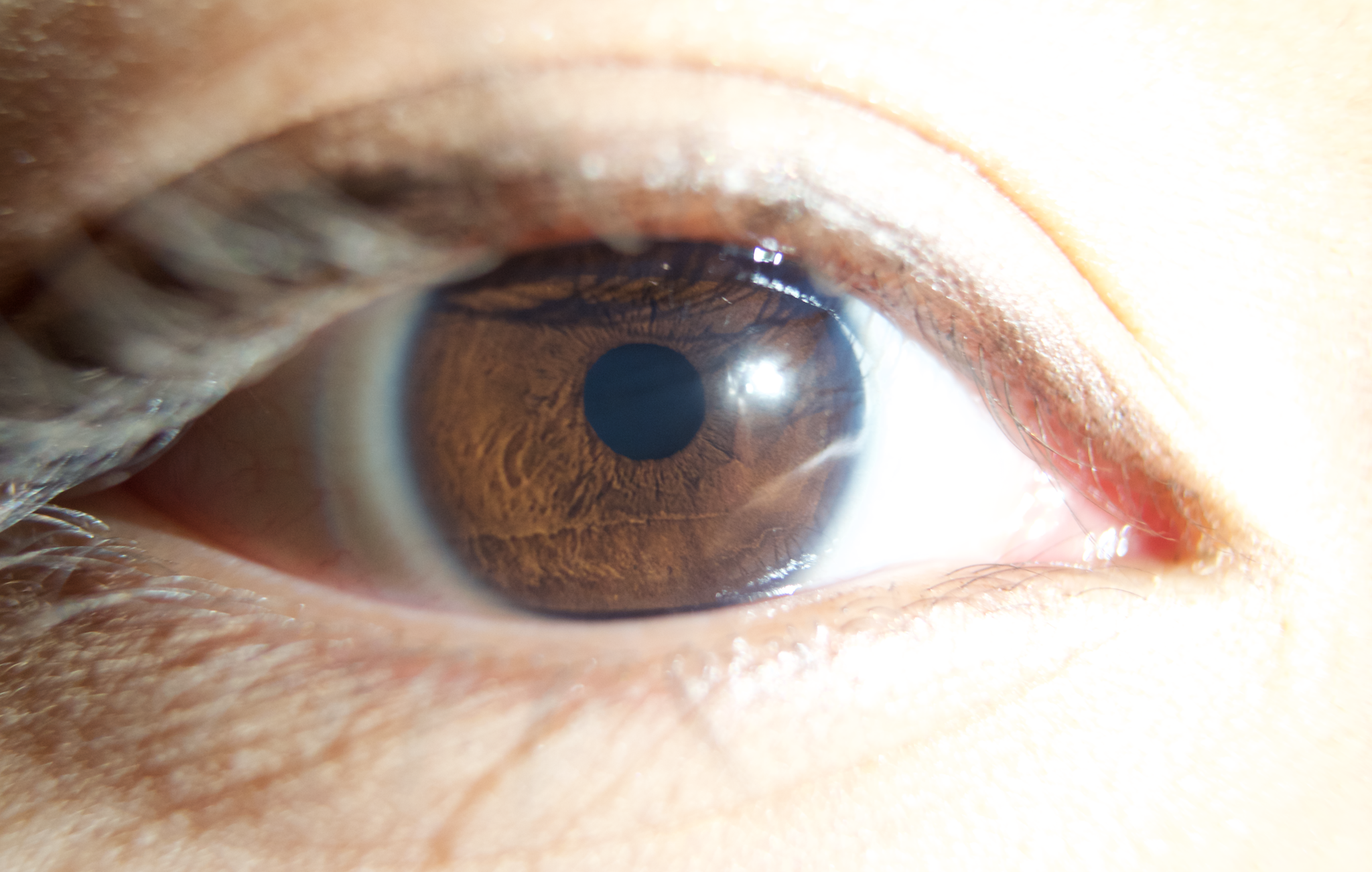 Eye see a problem